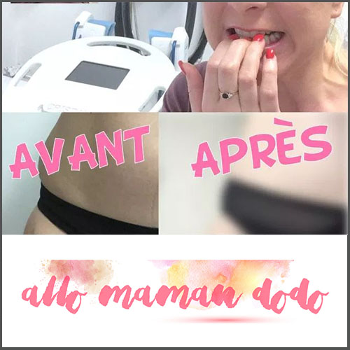 https://www.deleo-medical.com/allo-maman-dodo